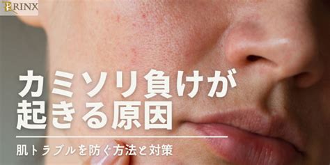 カミソリ負けの原因と対策を皮膚科医が徹底解説！ 